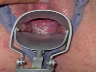 Milky cervix: フリー 高解像度の ポルノの 映画 図2c